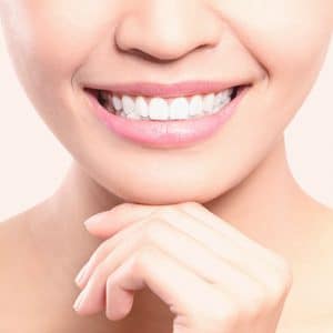 You Are Pretty Zahnbleaching Behandlung