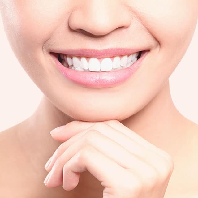 You Are Pretty Zahnbleaching Behandlung