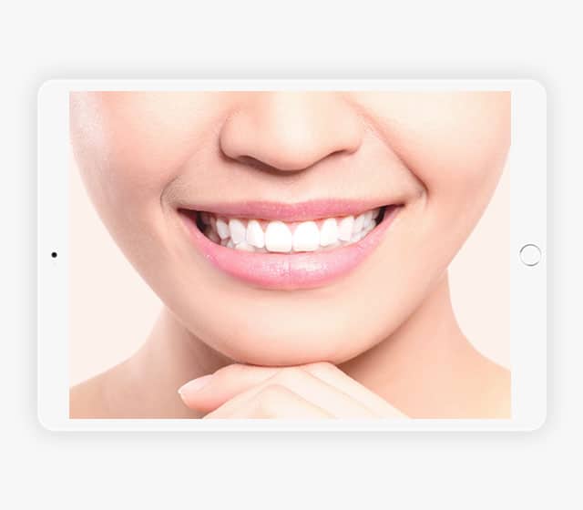 You Are Pretty Zahnbleaching Online Seminar