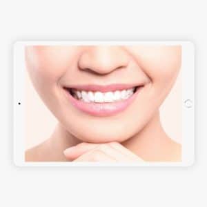 You Are Pretty Zahnbleaching Online Seminar