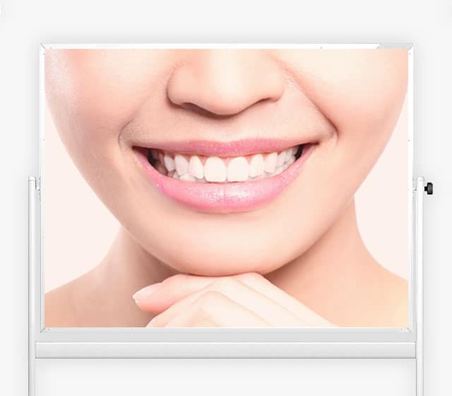 You Are Pretty Zahnbleaching Schulung