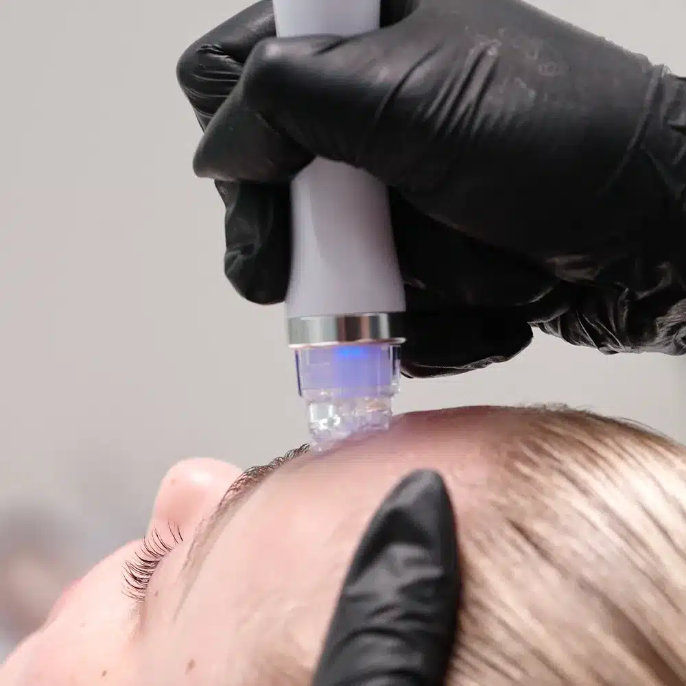 You Are Pretty Aqua Facial Master 4